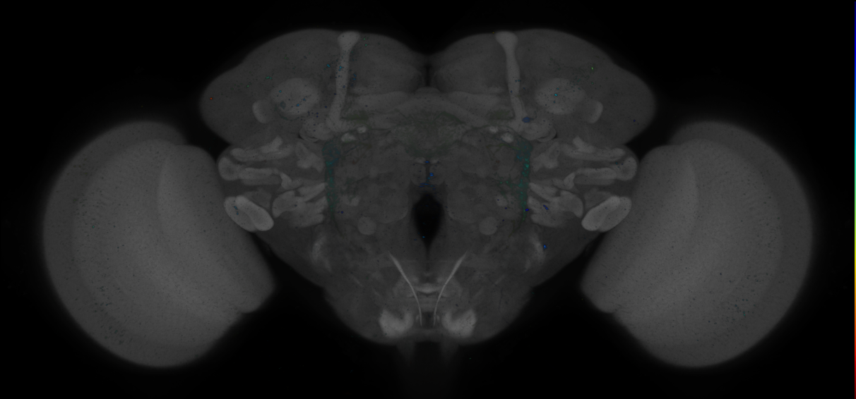 P{GMR75C04-GAL4} expression pattern