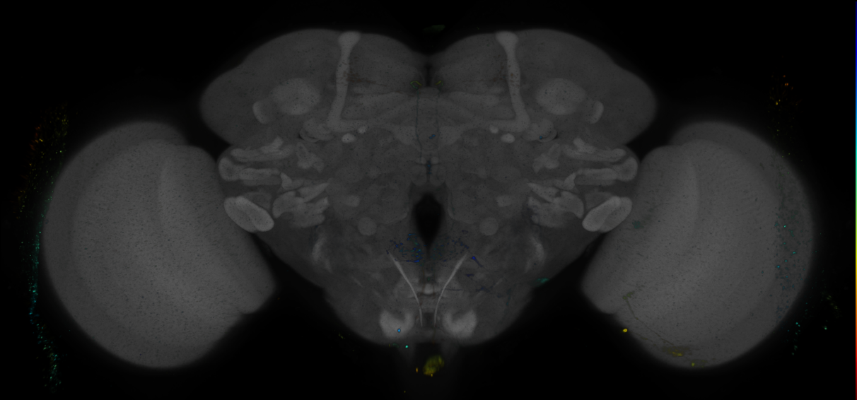 P{GMR19F04-GAL4} expression pattern