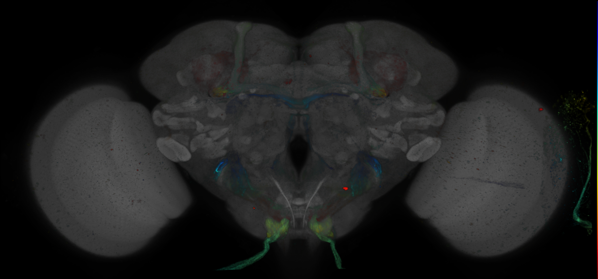 JRC_R34A01 GAL4 in the adult brain