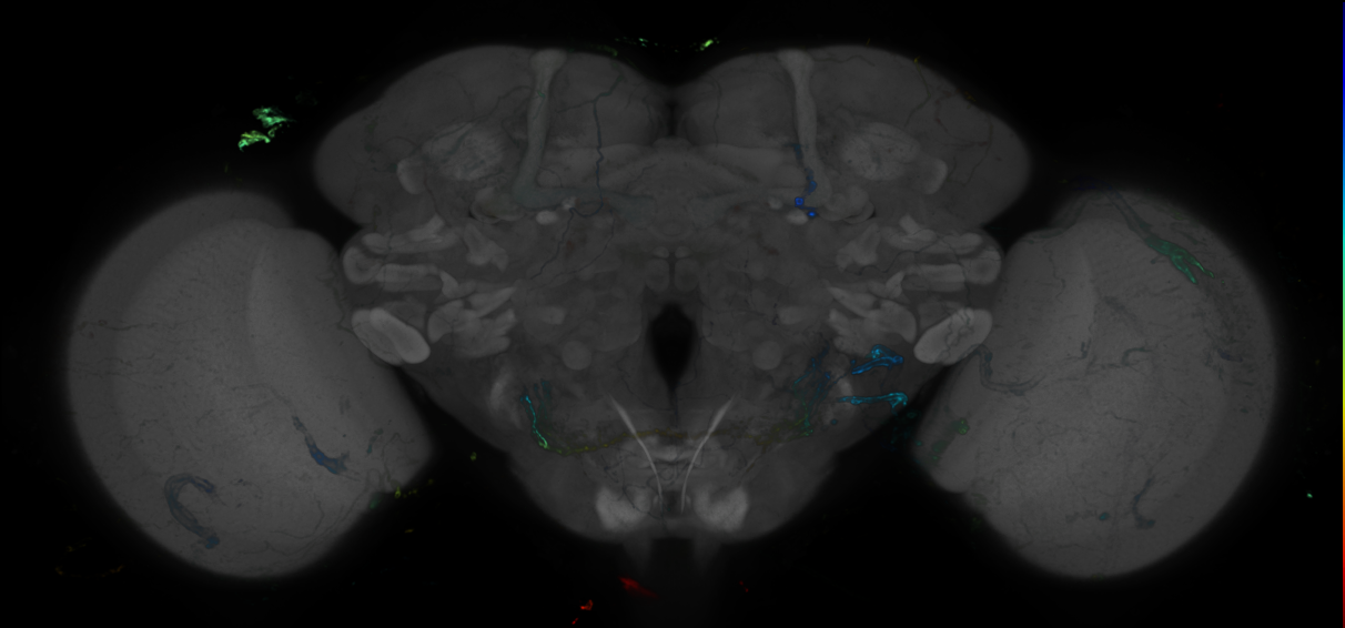 P{GMR45A11-GAL4} expression pattern