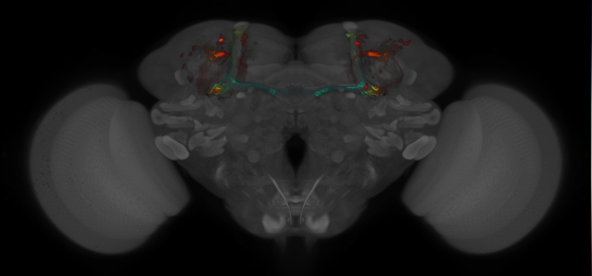 P{GMR20A05-GAL4} expression pattern