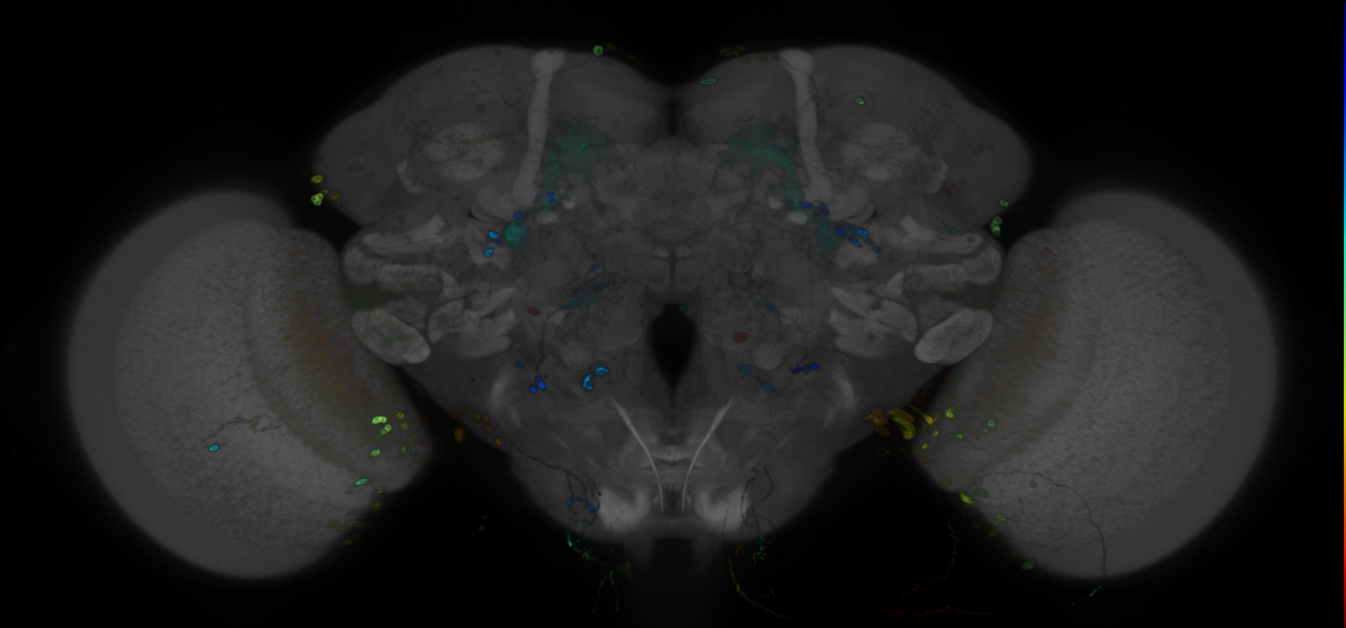 P{GMR31G04-GAL4} expression pattern