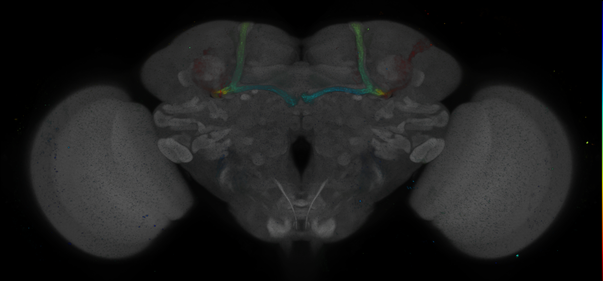 JRC_R76B07 GAL4 in the adult brain