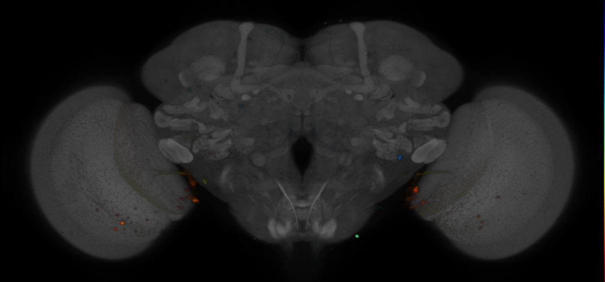 P{GMR75E11-GAL4} expression pattern
