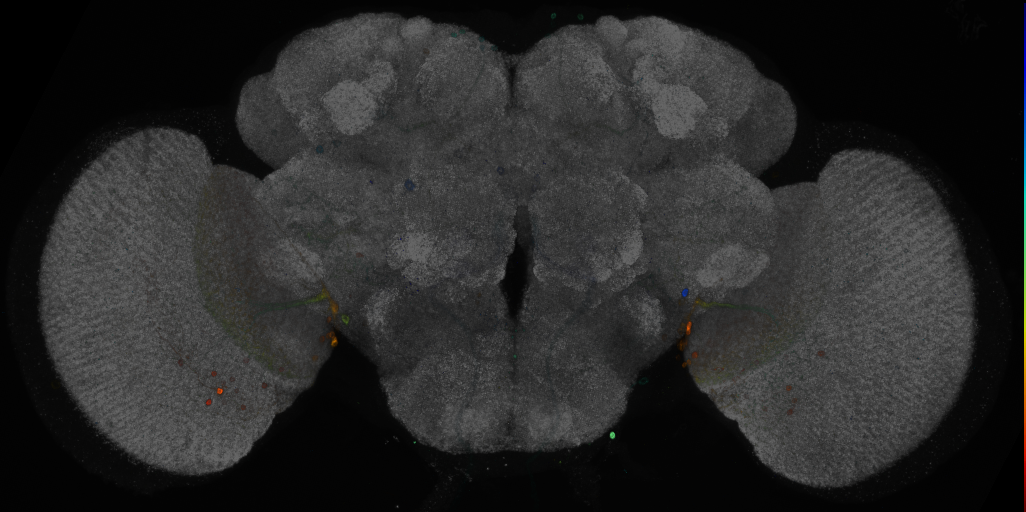 P{GMR75E11-GAL4} expression pattern