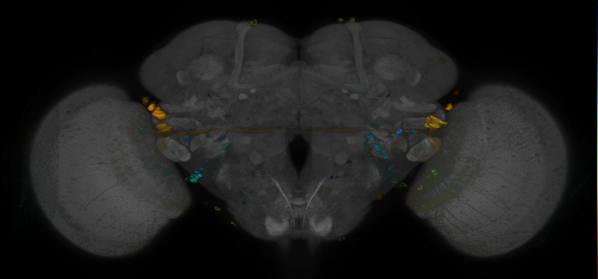 P{GMR93B11-GAL4} expression pattern