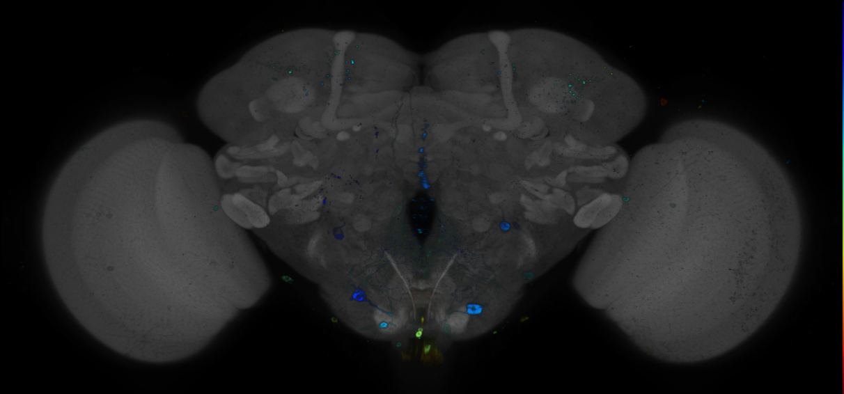 P{GMR93G11-GAL4} expression pattern