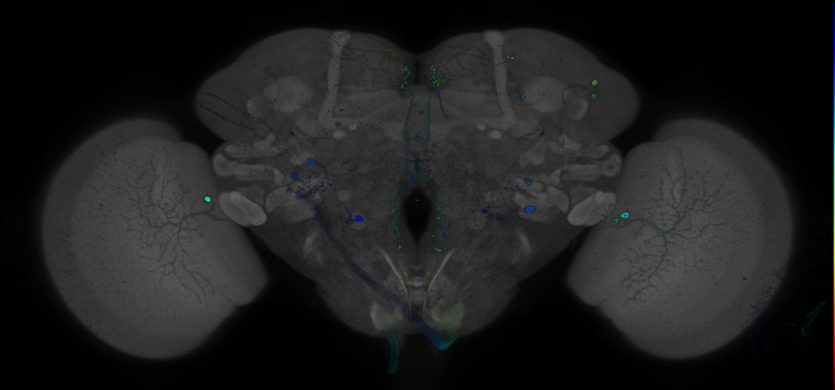 P{GMR64A06-GAL4} expression pattern