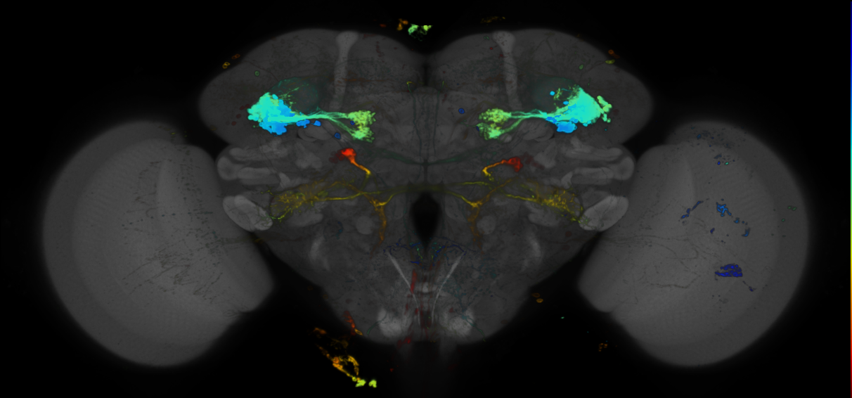 P{GMR76B06-GAL4} expression pattern