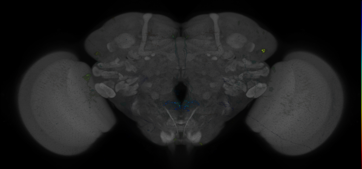 P{GMR11A10-GAL4} expression pattern