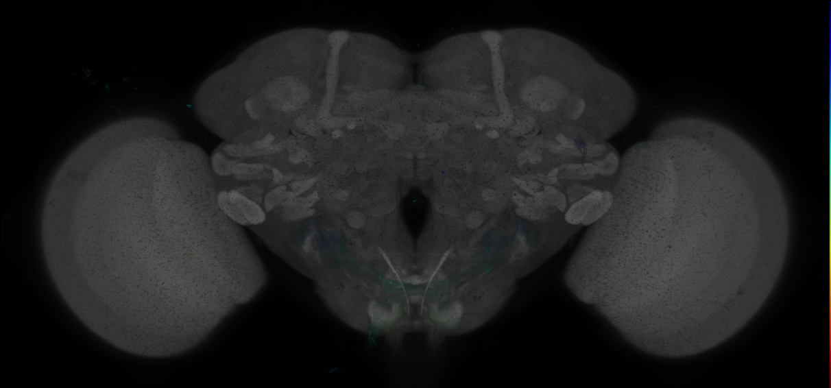 P{GMR15E09-GAL4} expression pattern
