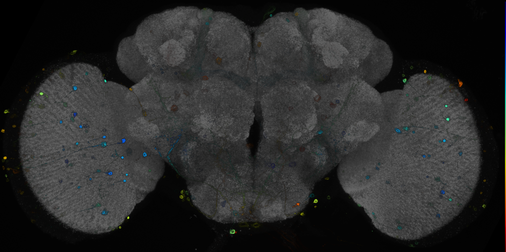 P{GMR11B06-GAL4} expression pattern