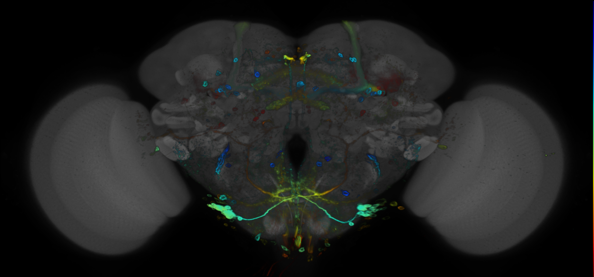 P{GMR31F06-GAL4} expression pattern