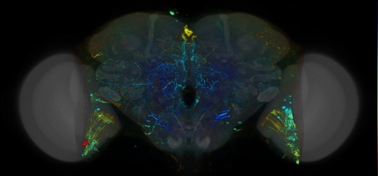 P{VT000460-GAL4} expression pattern