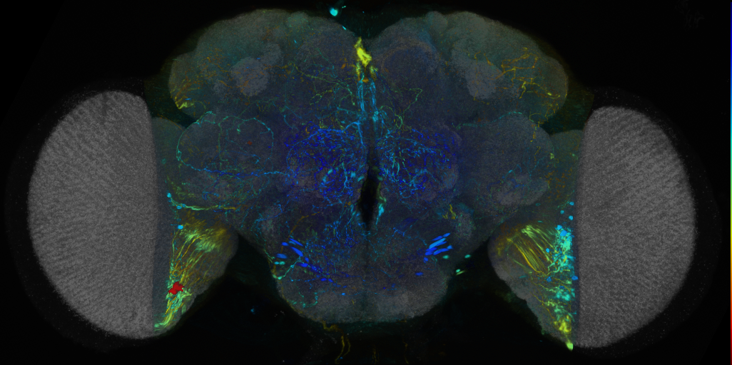 P{VT000460-GAL4} expression pattern