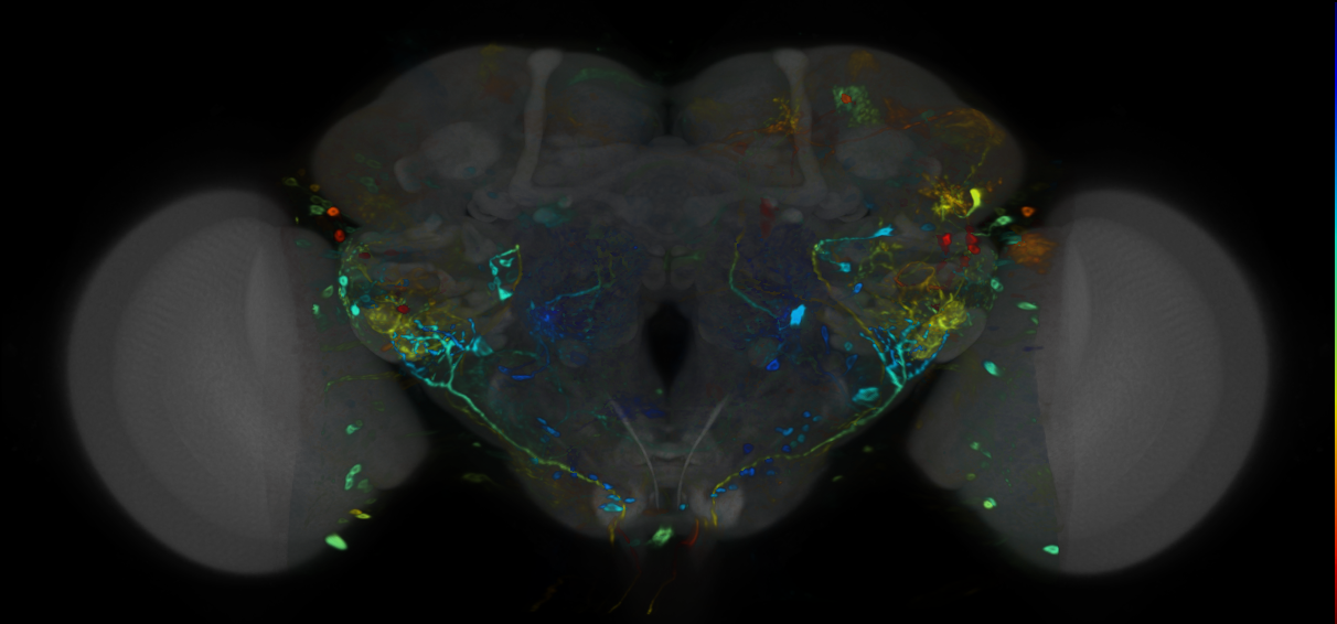 P{VT000848-GAL4} expression pattern