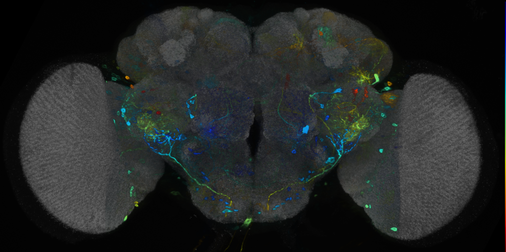 P{VT000848-GAL4} expression pattern
