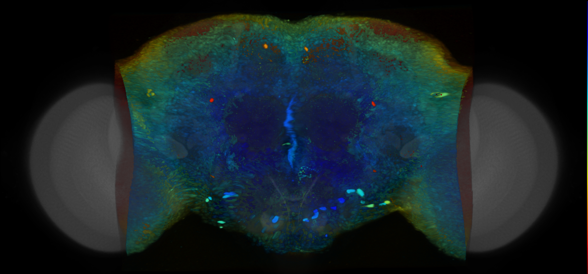 P{VT001422-GAL4} expression pattern