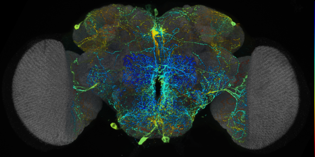 P{VT001426-GAL4} expression pattern