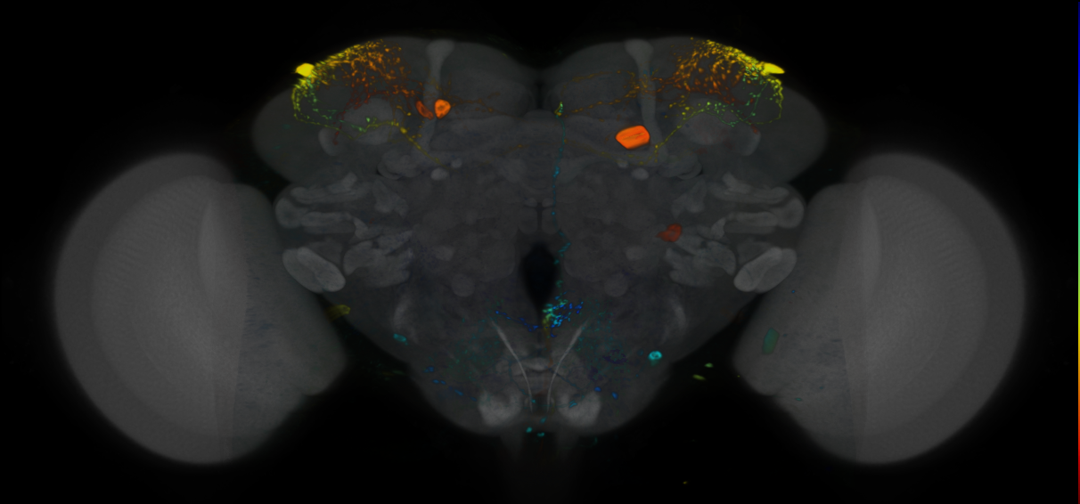 P{VT002017-GAL4} expression pattern