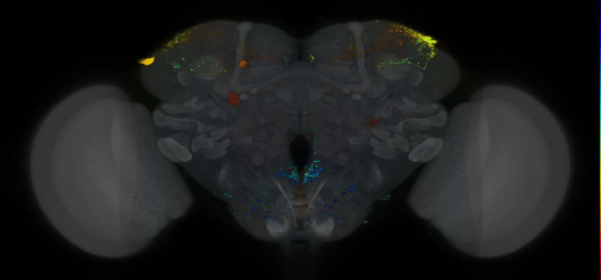 P{VT002017-GAL4} expression pattern