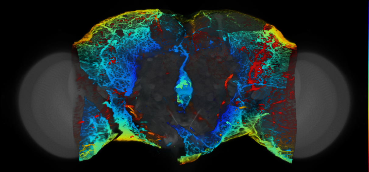 P{VT004241-GAL4} expression pattern