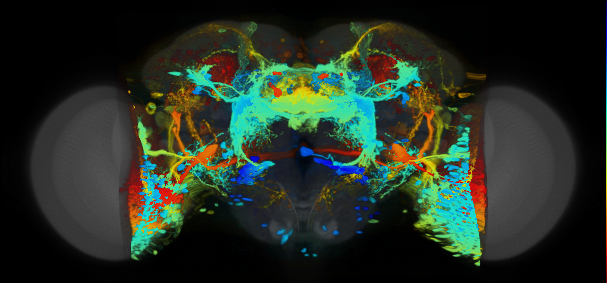P{VT004424-GAL4} expression pattern