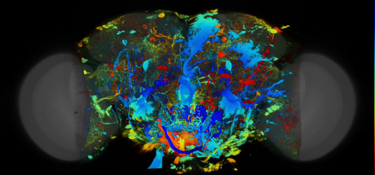 P{VT004434-GAL4} expression pattern