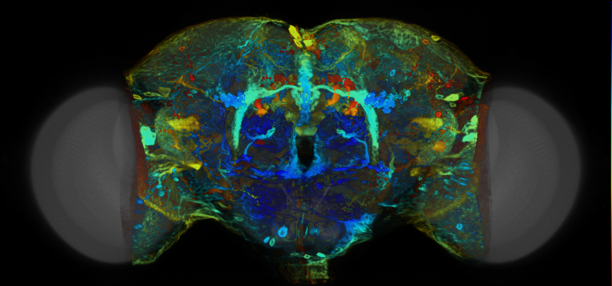 P{VT004443-GAL4} expression pattern
