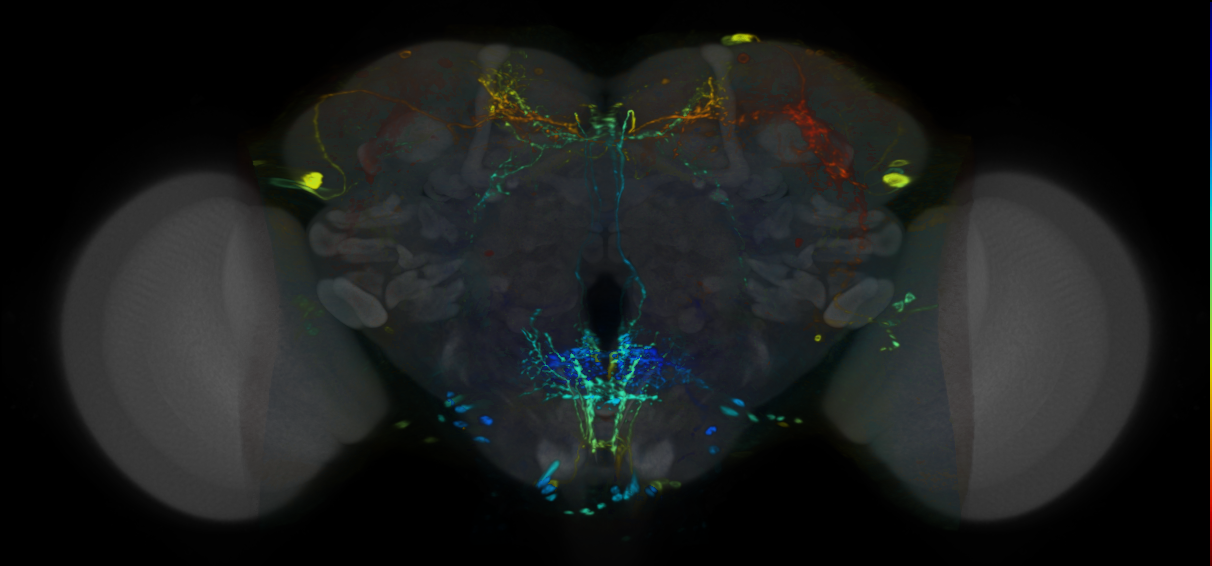 P{VT004450-GAL4} expression pattern