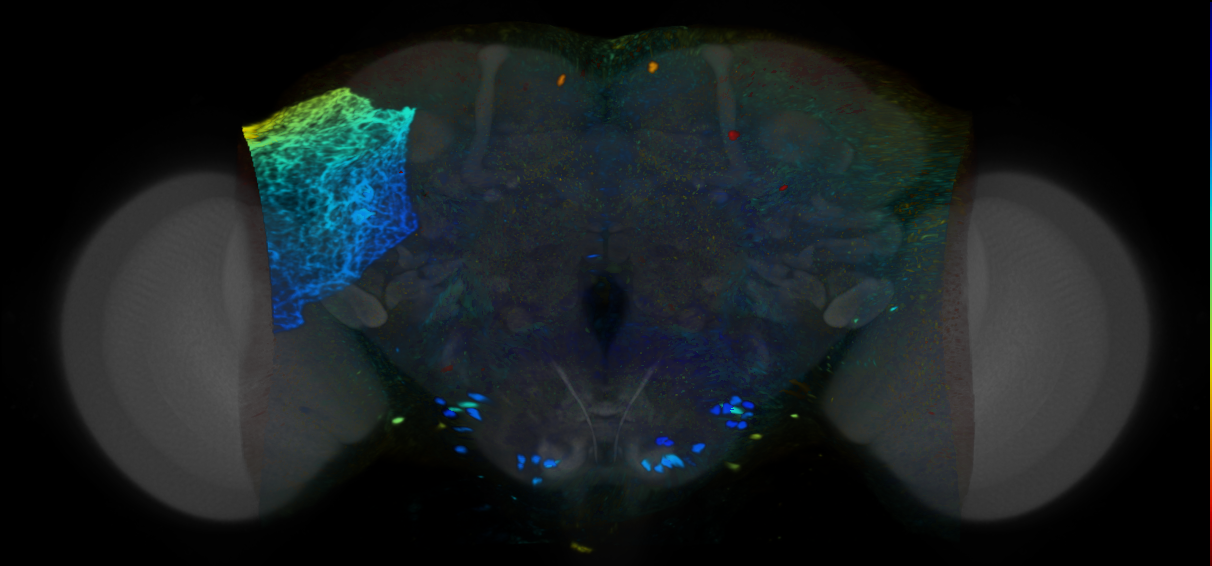 P{VT004451-GAL4} expression pattern