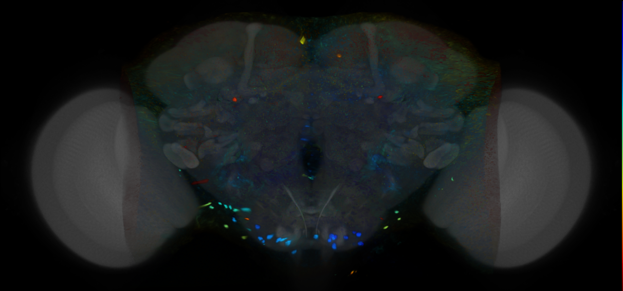 P{VT004451-GAL4} expression pattern