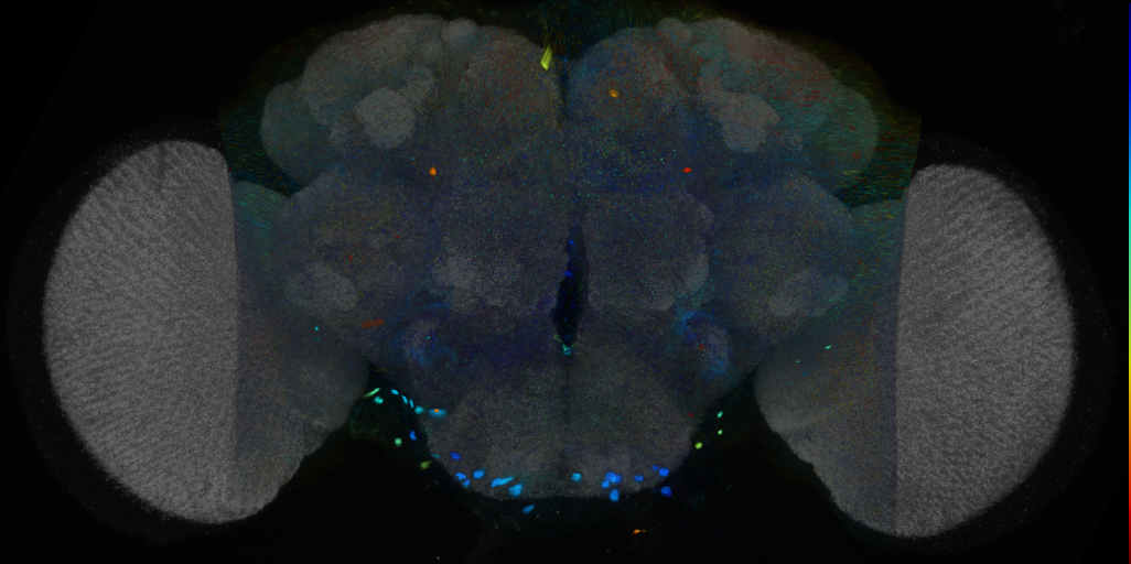 P{VT004451-GAL4} expression pattern