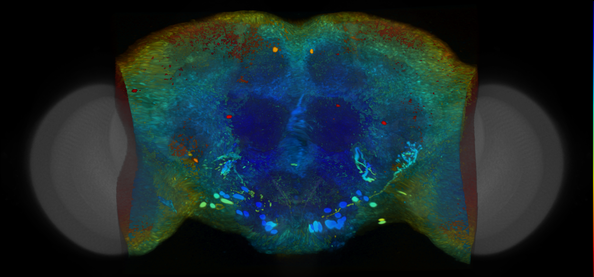 P{VT004698-GAL4} expression pattern