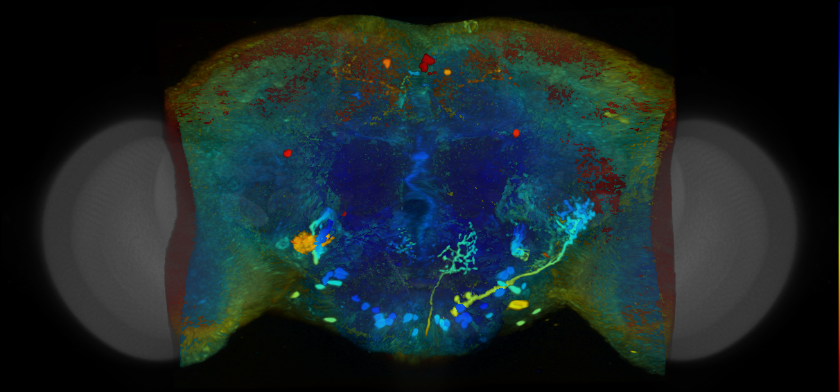 P{VT004698-GAL4} expression pattern