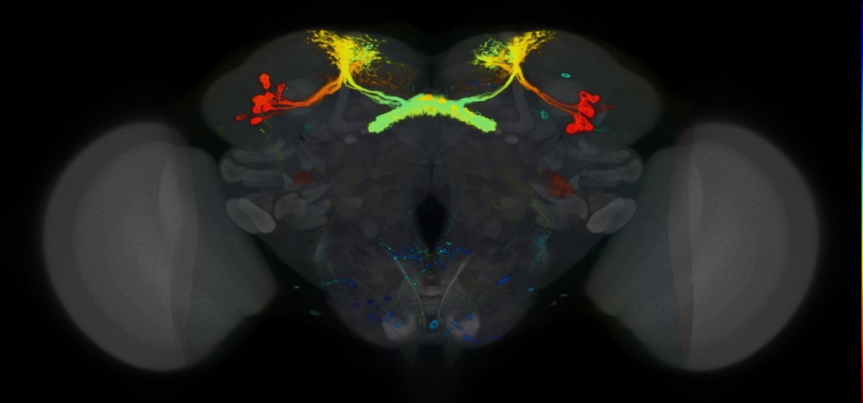 P{VT004849-GAL4} expression pattern