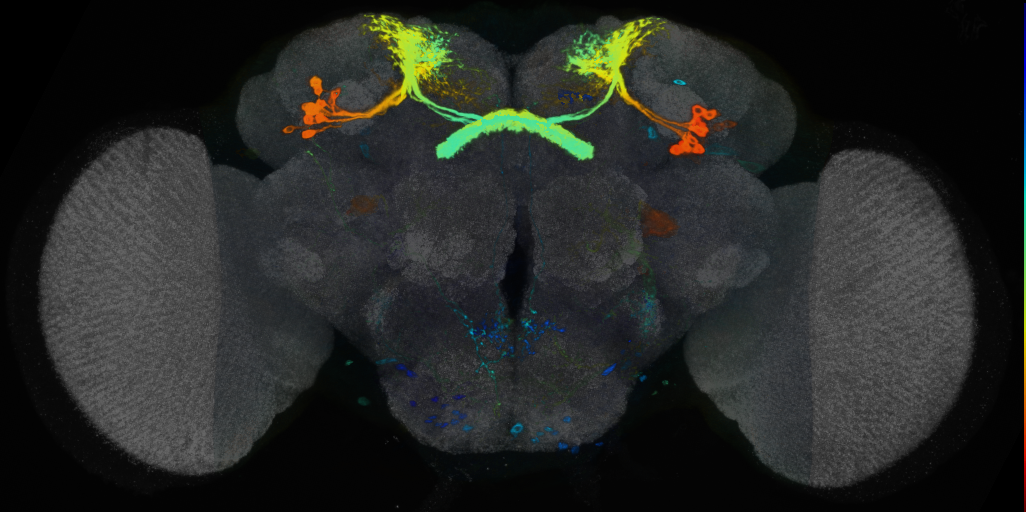 P{VT004849-GAL4} expression pattern