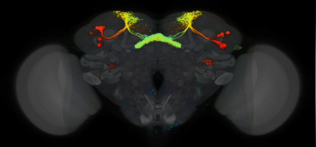 P{VT004849-GAL4} expression pattern