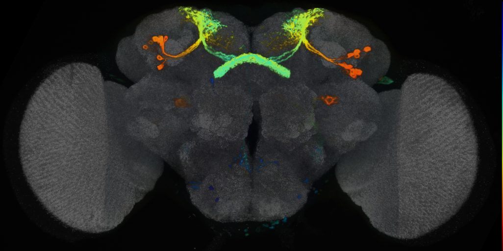 P{VT004849-GAL4} expression pattern