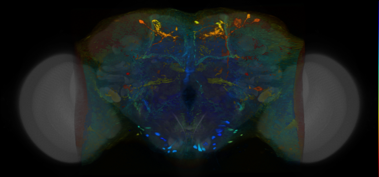 P{VT004851-GAL4} expression pattern