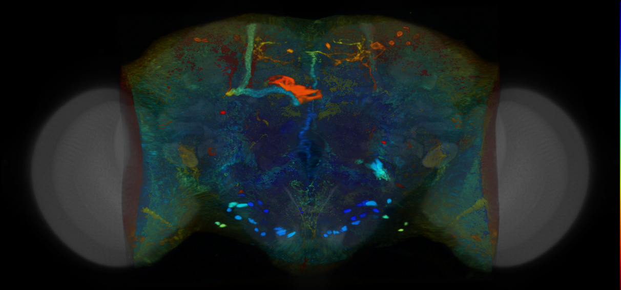 P{VT004851-GAL4} expression pattern