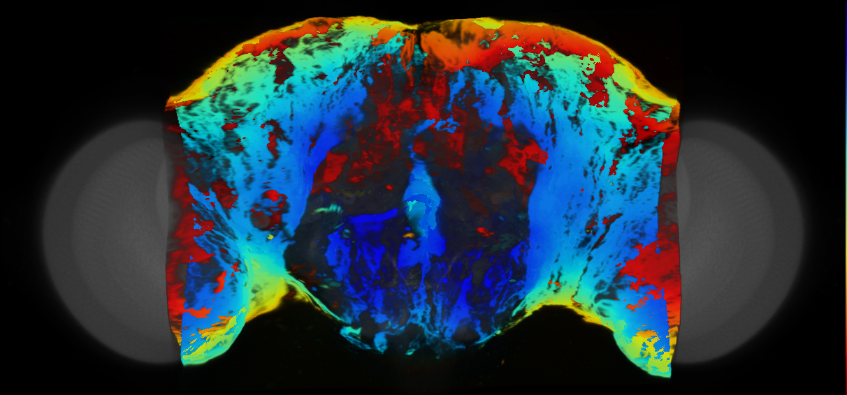 P{VT004956-GAL4} expression pattern