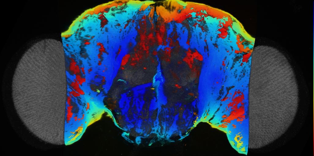 P{VT004956-GAL4} expression pattern