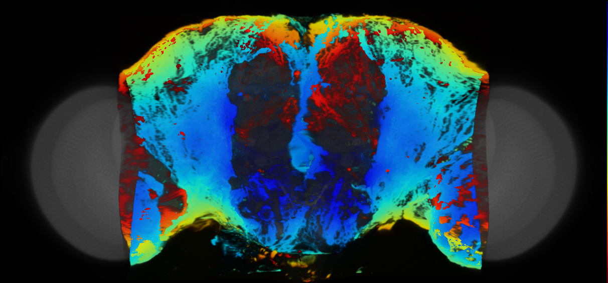 P{VT004956-GAL4} expression pattern