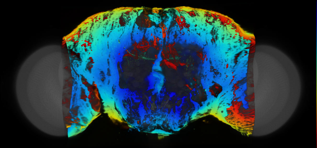 P{VT004956-GAL4} expression pattern