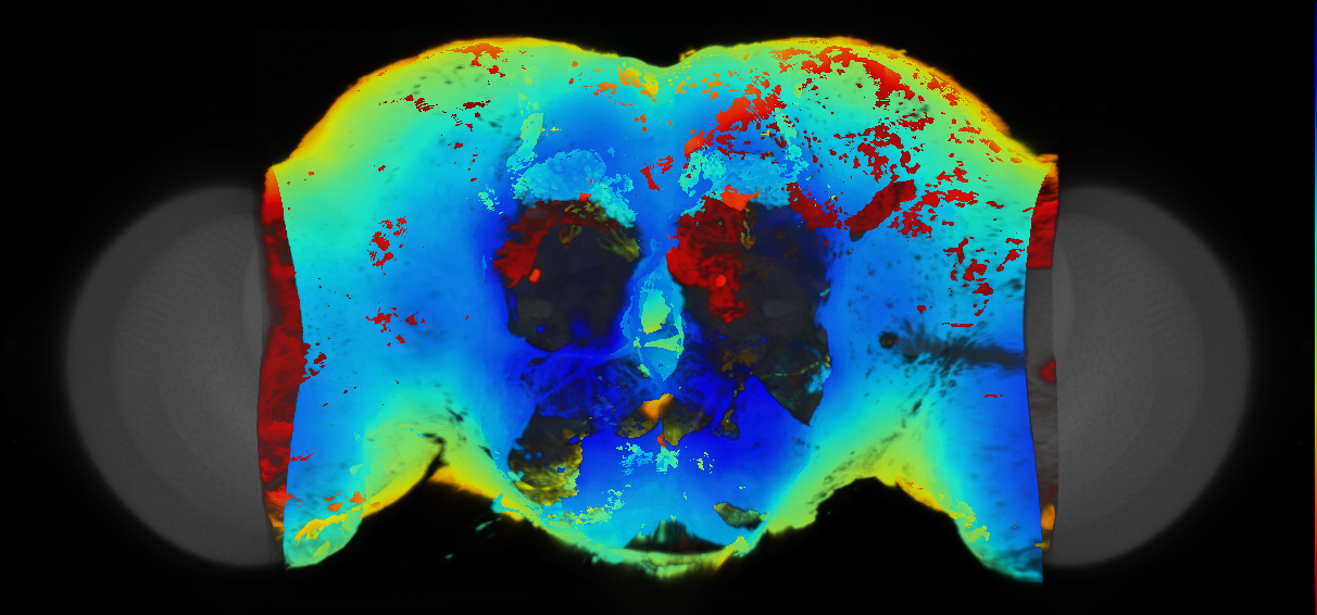 P{VT005057-GAL4} expression pattern