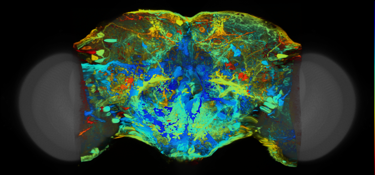 P{VT006415-GAL4} expression pattern