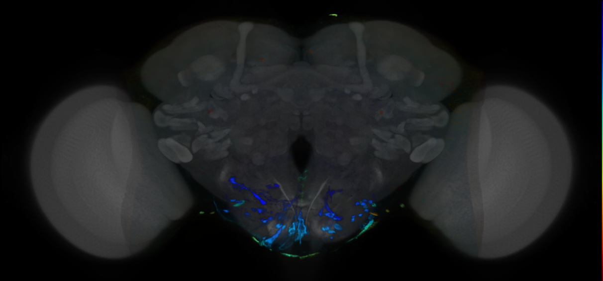 P{VT007263-GAL4} expression pattern