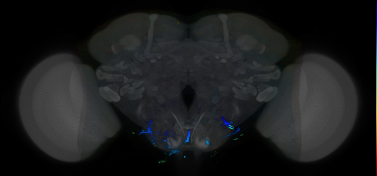 P{VT007263-GAL4} expression pattern