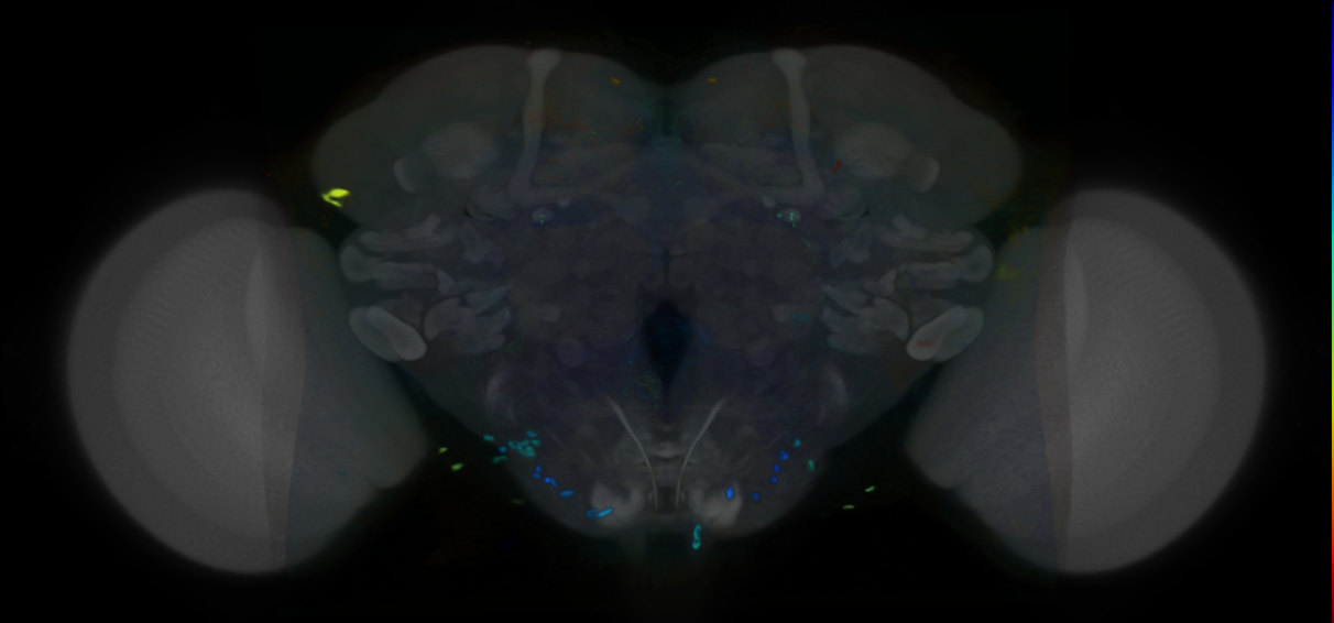 P{VT007575-GAL4} expression pattern